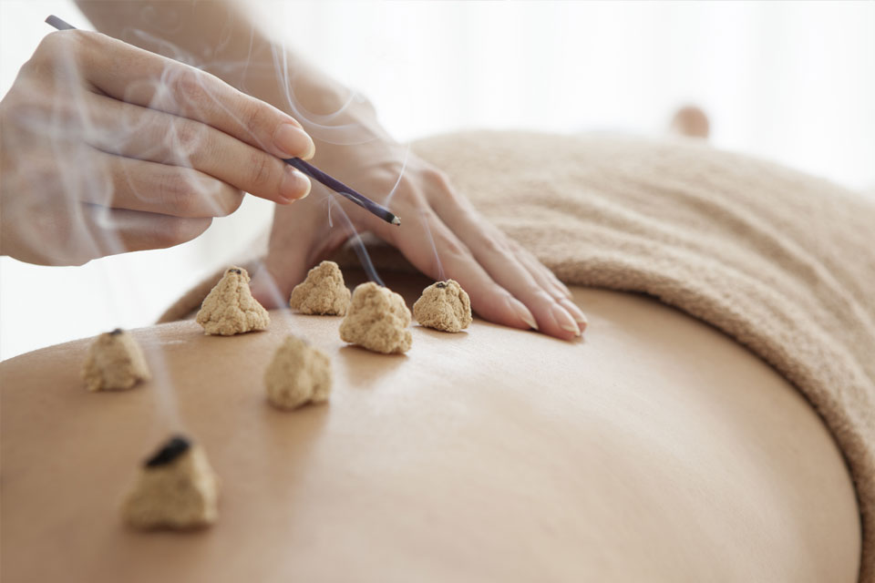 A person getting Moxa acupuncture.