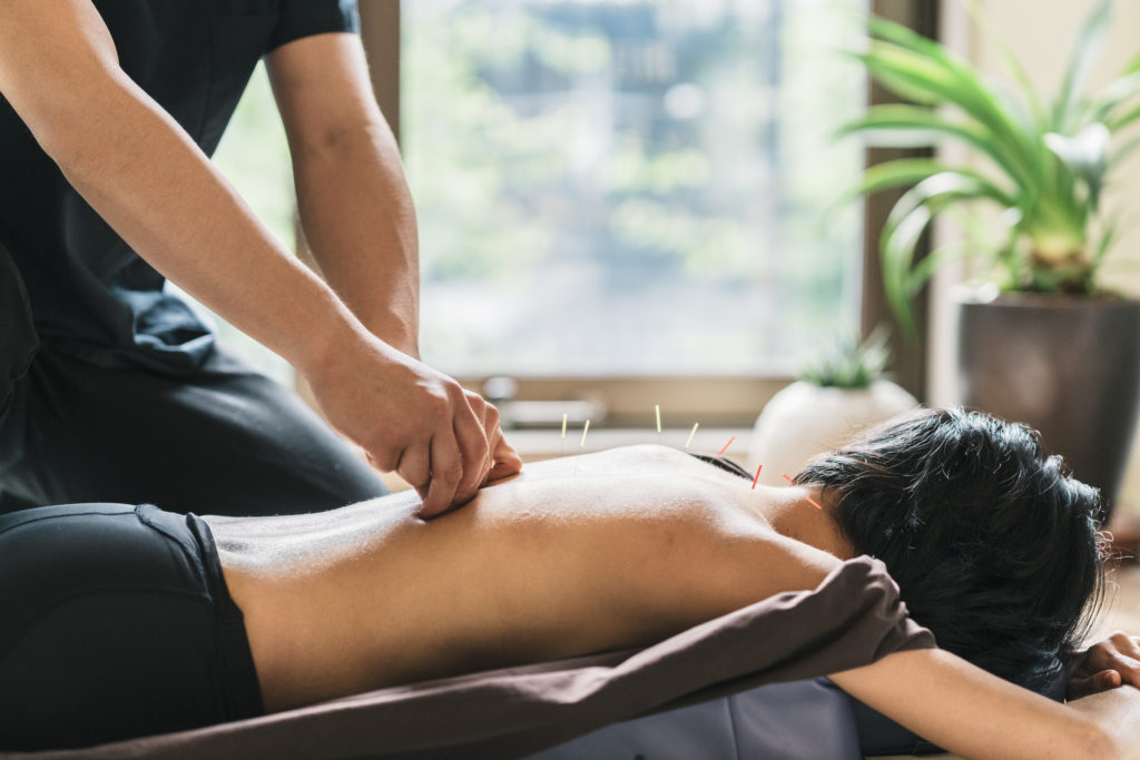 A person on a table with acupuncture needles in their back.