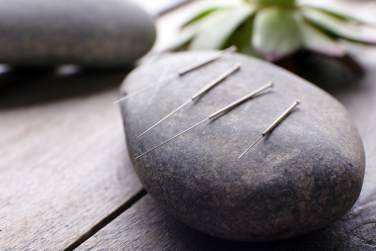 Acupuncture needles on a stone.